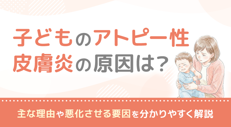 子どものアトピー性皮膚炎の原因は？主な理由や悪化させる要因を分かりやすく解説