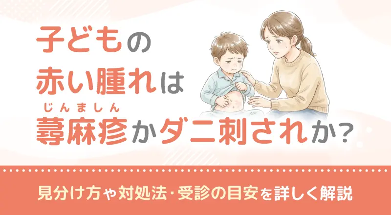 子どもの赤い腫れは蕁麻疹（じんましん）かダニ刺されか？見分け方や対処法・受診の目安を詳しく解説