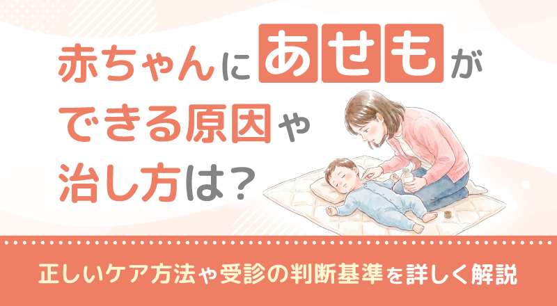 赤ちゃんにあせもができる原因や治し方は？正しいケア方法や受診の判断基準を詳しく解説