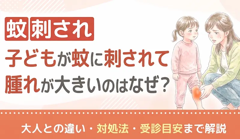 子どもが蚊に刺されて腫れが大きいのはなぜ？大人との違い・対処法・受診目安まで解説