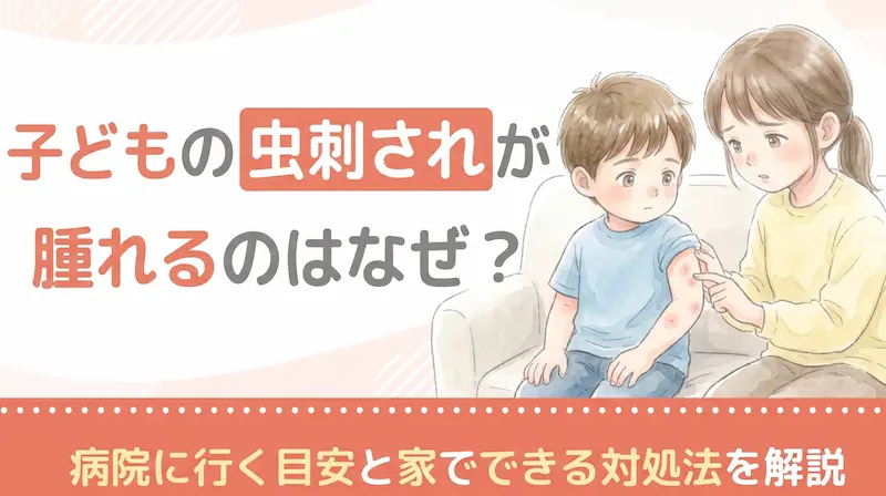 子どもの虫刺されが腫れるのはなぜ？病院に行く目安と家でできる対処法を解説