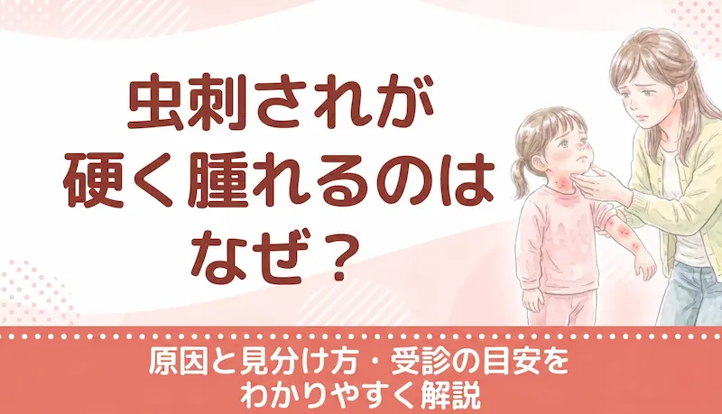 虫刺されが硬く腫れるのはなぜ？原因と見分け方・受診の目安をわかりやすく解説