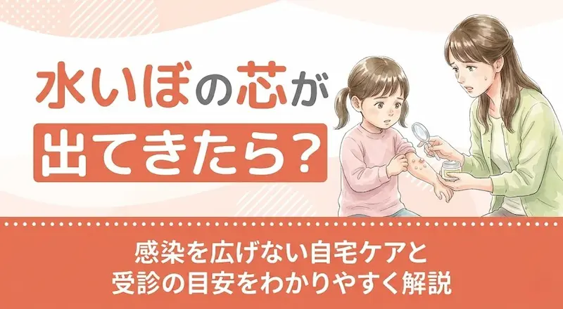 水いぼの芯が出てきたら？感染を広げない自宅ケアと受診の目安をわかりやすく解説