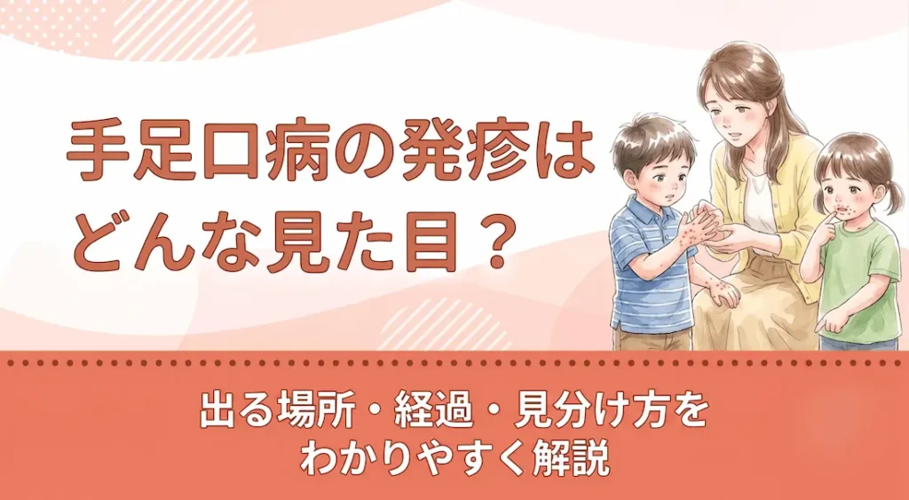 手足口病の発疹はどんな見た目？出る場所・経過・見分け方をわかりやすく解説